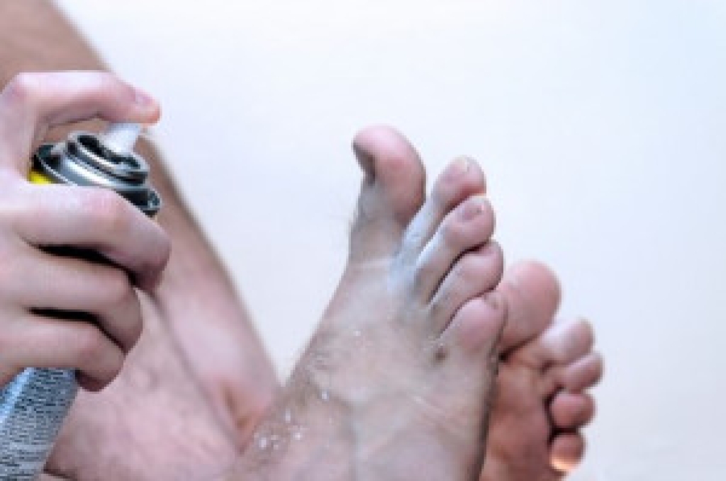 Causes and Treatment of Athlete’s Foot