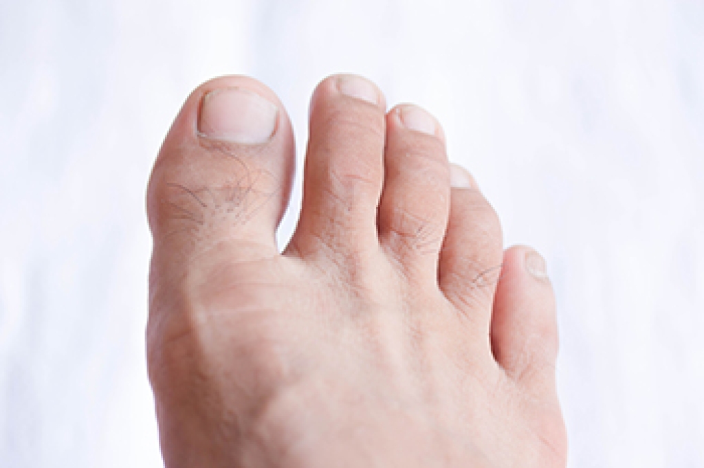 Swollen Big Toe Causes and Symptoms